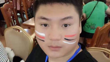 老李透露阿阳伤情,已无大碍